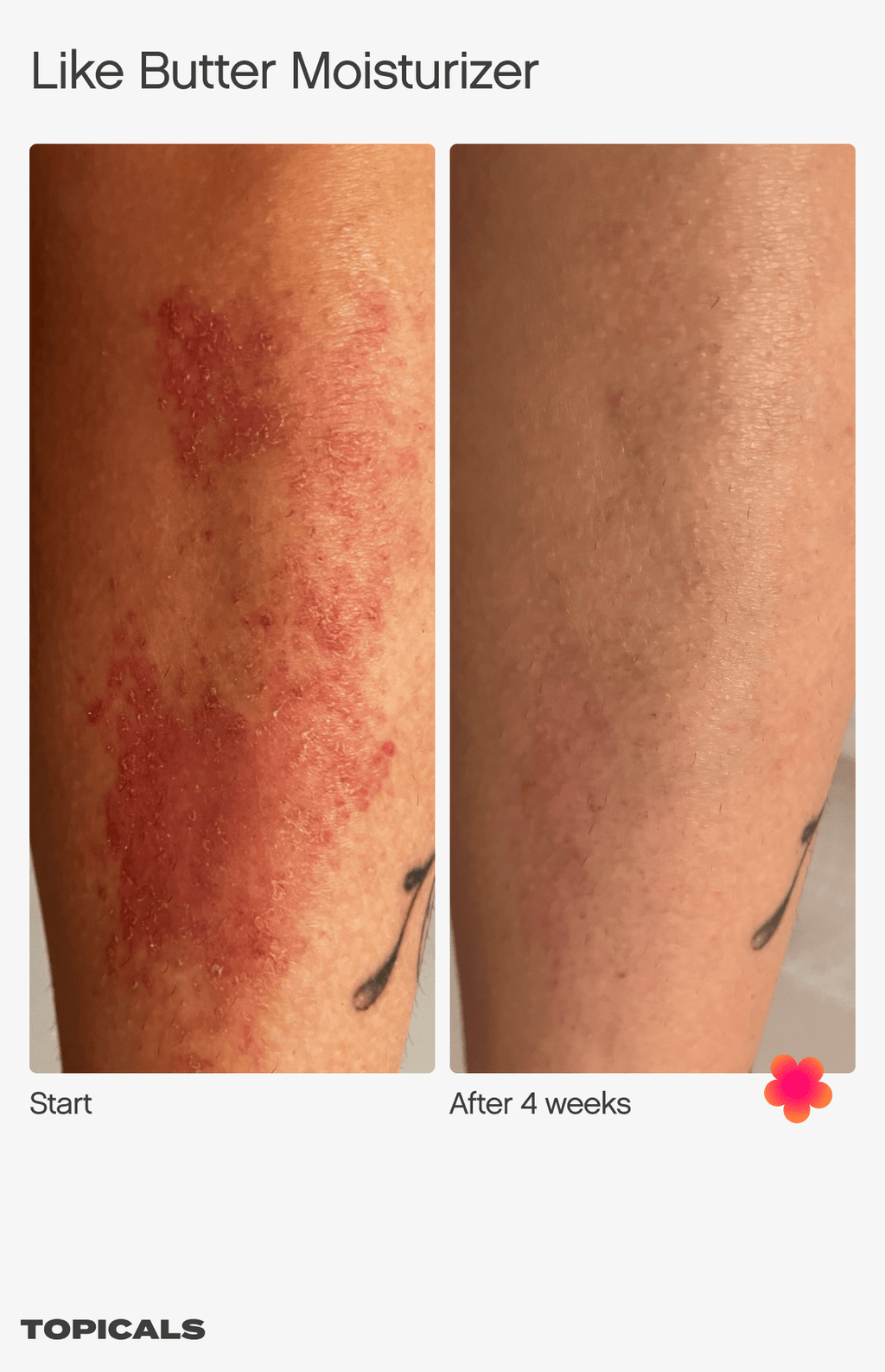 skin moisturizer cream